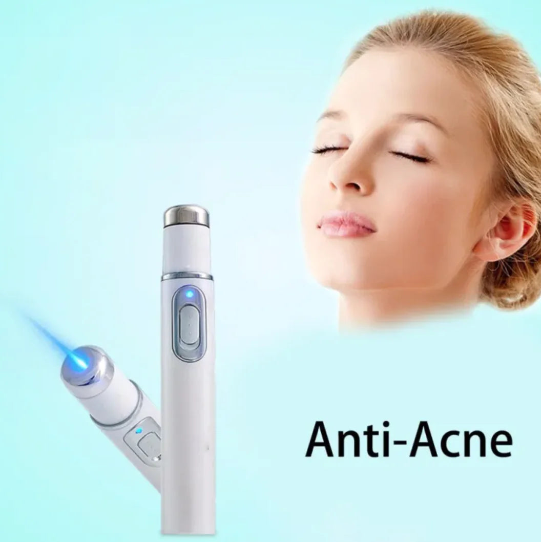 Blue Light Therapy Acne Pen – Effektiv mod uren hud