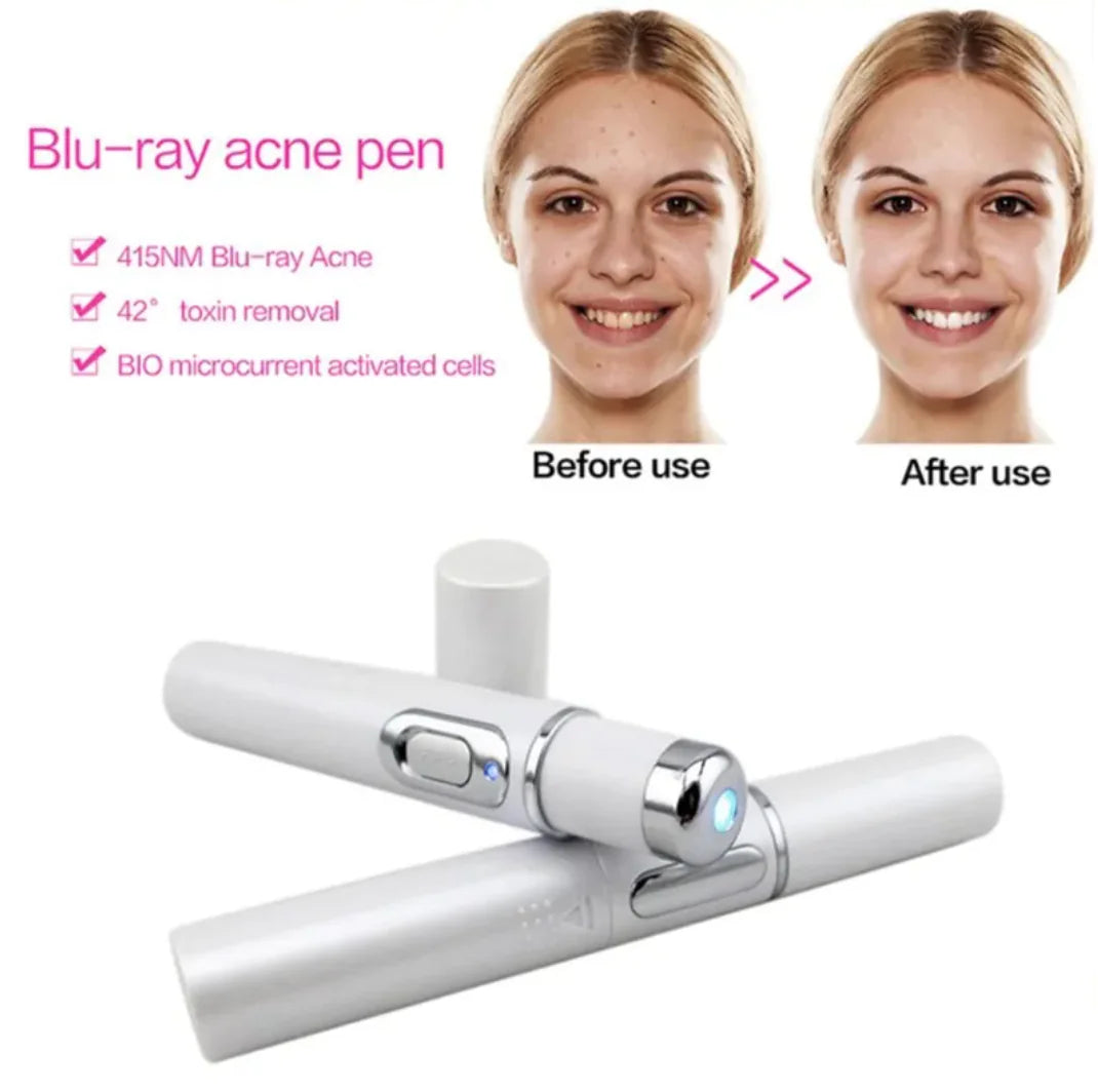 Blue Light Therapy Acne Pen – Effektiv mod uren hud